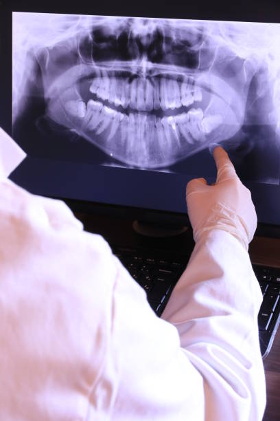 Best Emergency Dentist for Lost Fillings or Crowns in Green Valley, MD