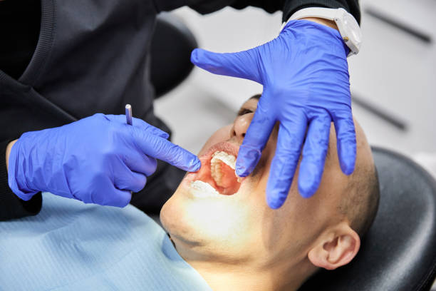 Best Emergency Dentist for Knocked-Out Tooth in Green Valley, MD