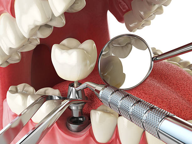Best Orthodontic Emergency Dentist in Green Valley, MD